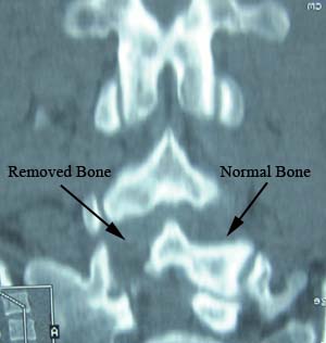 ct scan