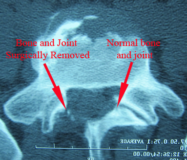 ct scan